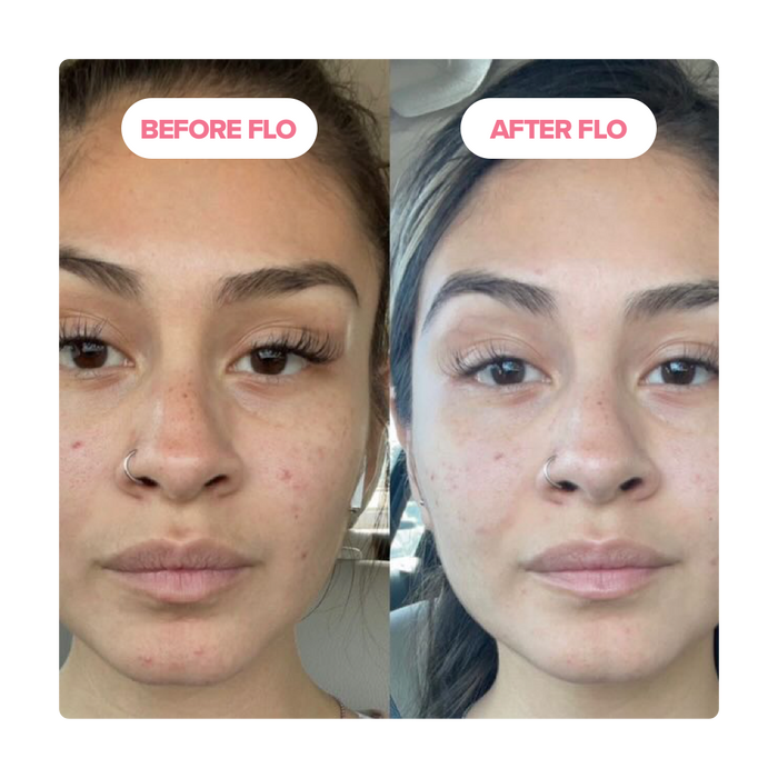 FLO - Period Relief Gummy Vitamins Trial