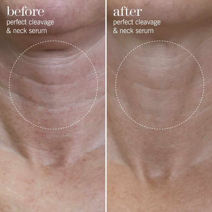 perfect cleavage & neck serum