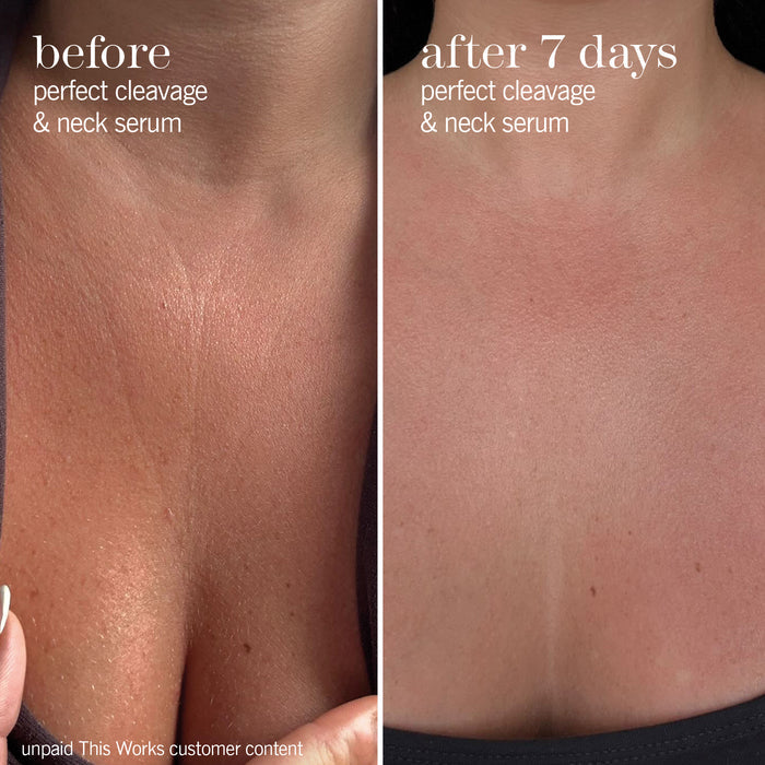 perfect cleavage & neck serum